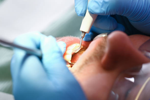 Best Broken Tooth Emergency  in Janesville, CA