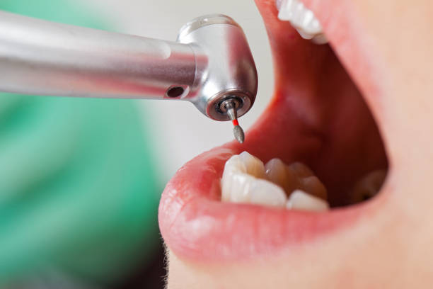 Best Emergency Gum Pain Relief  in Janesville, CA